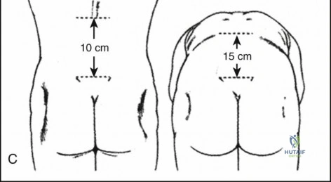Clinical Image