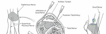 Clinical Image