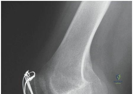Clinical Image