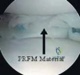 Clinical Image