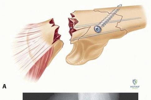 Clinical Image