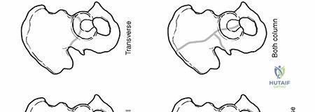 Clinical Image