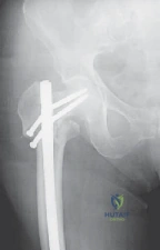 Clinical Image