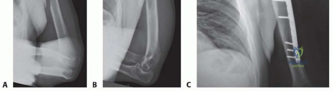 Clinical Image