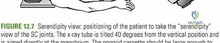 Clinical Image