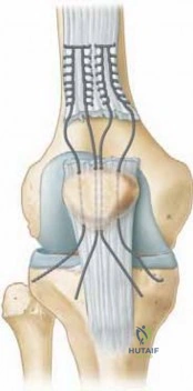 Clinical Image