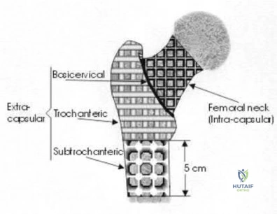 Illustration 211 for OrthoCash: Trauma MCQs & Cases for a yearold woman