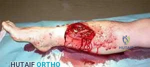 Illustration 212 for OrthoCash: Trauma MCQs & Cases for a yearold woman