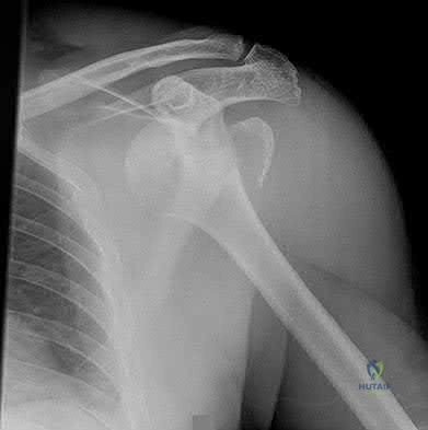 Illustration 214 for OrthoCash: Trauma MCQs & Cases for a yearold woman