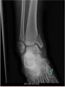 Illustration 216 for OrthoCash: Trauma MCQs & Cases for a yearold woman
