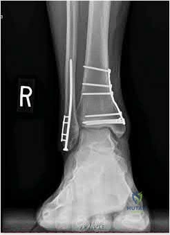 Illustration 217 for OrthoCash: Trauma MCQs & Cases for a yearold woman
