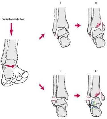 Illustration 218 for OrthoCash: Trauma MCQs & Cases for a yearold woman