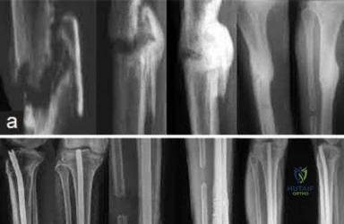 Illustration 220 for OrthoCash: Trauma MCQs & Cases for a yearold woman