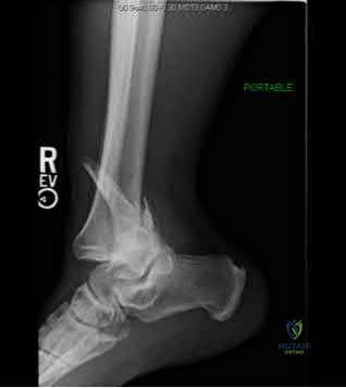 Illustration 223 for OrthoCash: Trauma MCQs & Cases for a yearold woman