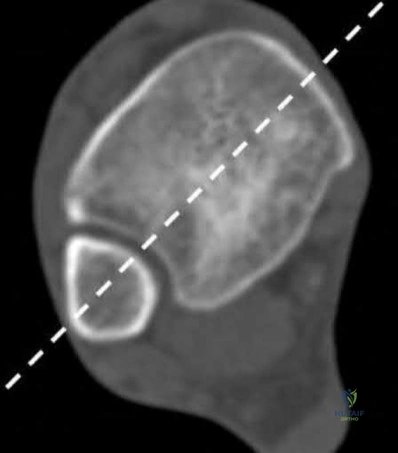 Illustration 226 for OrthoCash: Trauma MCQs & Cases for a yearold woman