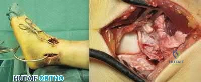 Illustration 228 for OrthoCash: Trauma MCQs & Cases for a yearold woman