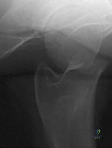 Illustration 230 for OrthoCash: Trauma MCQs & Cases for a yearold woman