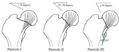 Illustration 231 for OrthoCash: Trauma MCQs & Cases for a yearold woman