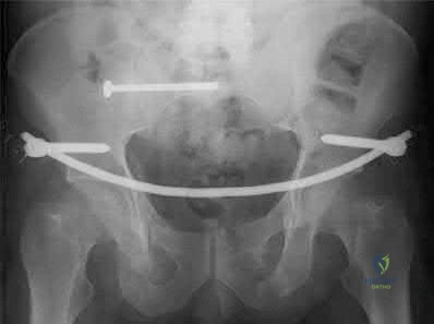 Illustration 232 for OrthoCash: Trauma MCQs & Cases for a yearold woman