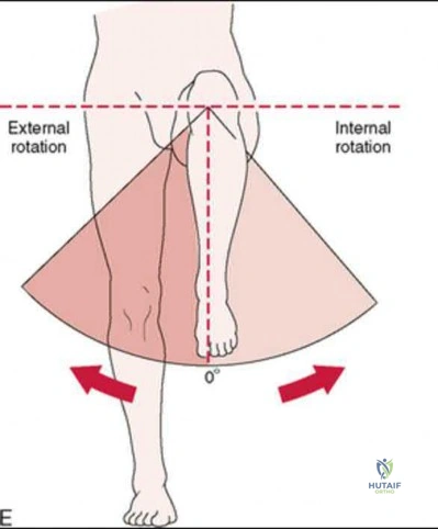 Illustration 235 for OrthoCash: Trauma MCQs & Cases for a yearold woman