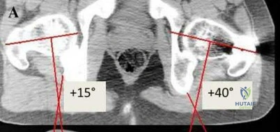 Illustration 238 for OrthoCash: Trauma MCQs & Cases for a yearold woman