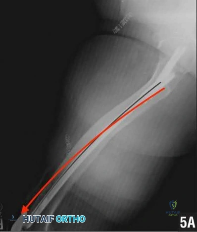 Illustration 250 for OrthoCash: Trauma MCQs & Cases for a yearold woman