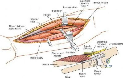 Illustration 251 for OrthoCash: Trauma MCQs & Cases for a yearold woman