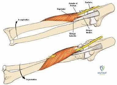 Illustration 252 for OrthoCash: Trauma MCQs & Cases for a yearold woman