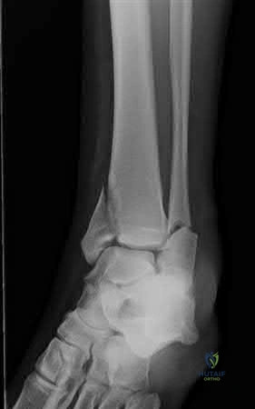 Illustration 255 for OrthoCash: Trauma MCQs & Cases for a yearold woman