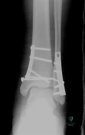 Illustration 256 for OrthoCash: Trauma MCQs & Cases for a yearold woman