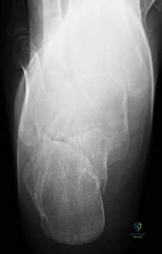 Illustration 259 for OrthoCash: Trauma MCQs & Cases for a yearold woman