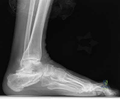 Illustration 260 for OrthoCash: Trauma MCQs & Cases for a yearold woman