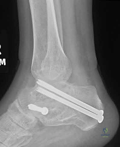 Illustration 261 for OrthoCash: Trauma MCQs & Cases for a yearold woman