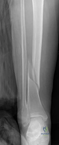 Illustration 263 for OrthoCash: Trauma MCQs & Cases for a yearold woman