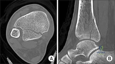 Illustration 264 for OrthoCash: Trauma MCQs & Cases for a yearold woman