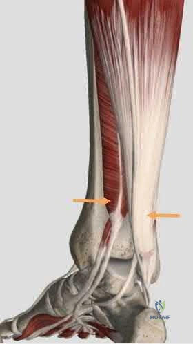 Illustration 265 for OrthoCash: Trauma MCQs & Cases for a yearold woman