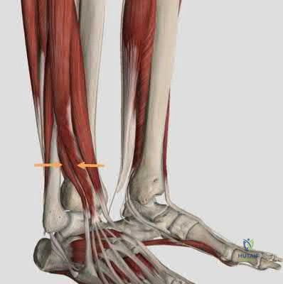 Illustration 266 for OrthoCash: Trauma MCQs & Cases for a yearold woman