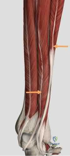 Illustration 267 for OrthoCash: Trauma MCQs & Cases for a yearold woman