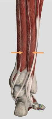 Illustration 268 for OrthoCash: Trauma MCQs & Cases for a yearold woman