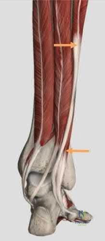 Illustration 269 for OrthoCash: Trauma MCQs & Cases for a yearold woman