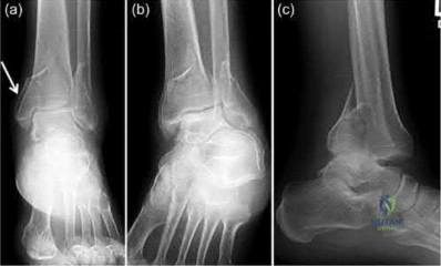 Illustration 272 for OrthoCash: Trauma MCQs & Cases for a yearold woman