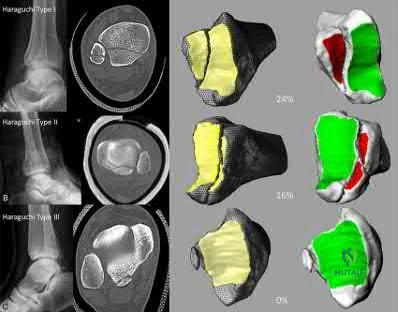 Illustration 273 for OrthoCash: Trauma MCQs & Cases for a yearold woman