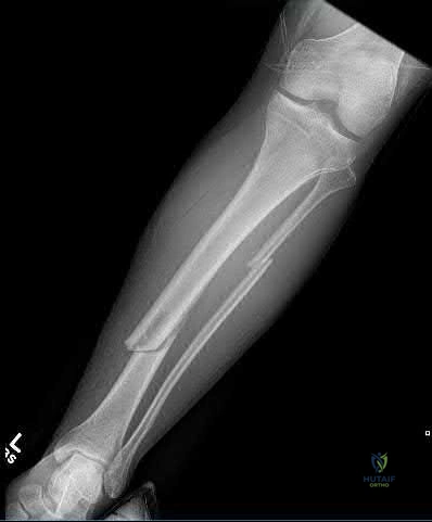 Illustration 275 for OrthoCash: Trauma MCQs & Cases for a yearold woman