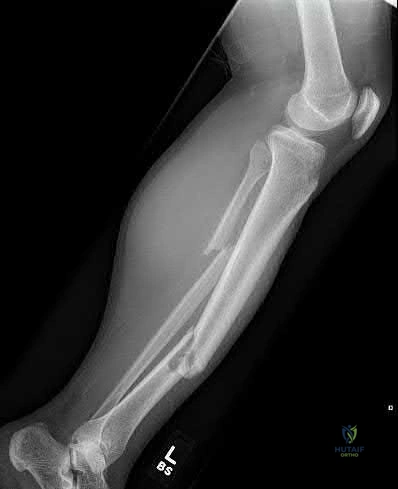 Illustration 276 for OrthoCash: Trauma MCQs & Cases for a yearold woman