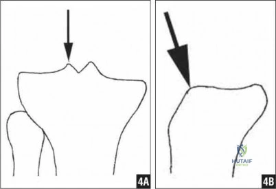 Illustration 277 for OrthoCash: Trauma MCQs & Cases for a yearold woman