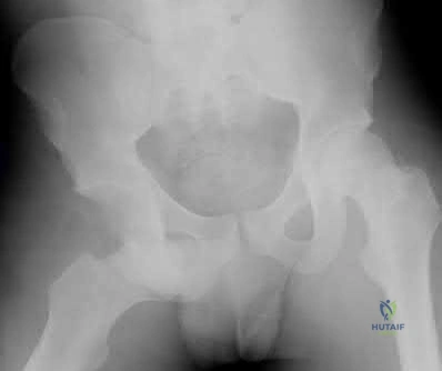 Illustration 278 for OrthoCash: Trauma MCQs & Cases for a yearold woman