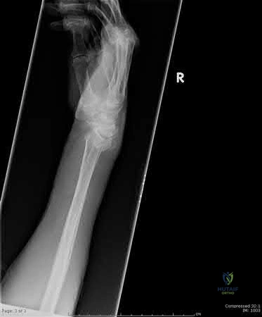 Illustration 279 for OrthoCash: Trauma MCQs & Cases for a yearold woman