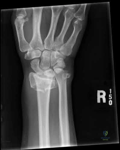 Illustration 280 for OrthoCash: Trauma MCQs & Cases for a yearold woman