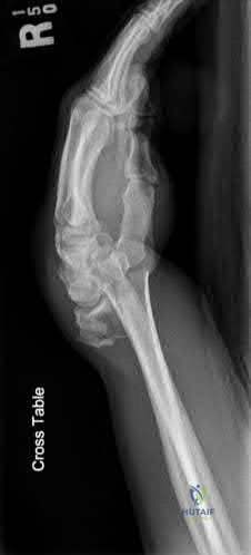 Illustration 281 for OrthoCash: Trauma MCQs & Cases for a yearold woman