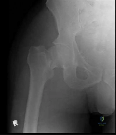 Illustration 286 for OrthoCash: Trauma MCQs & Cases for a yearold woman